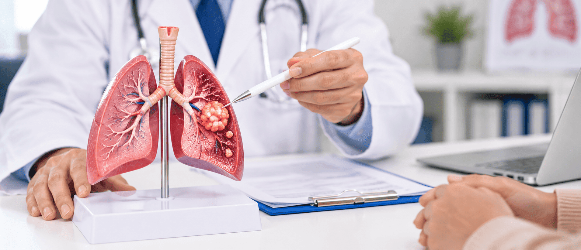 Lung cancer.png