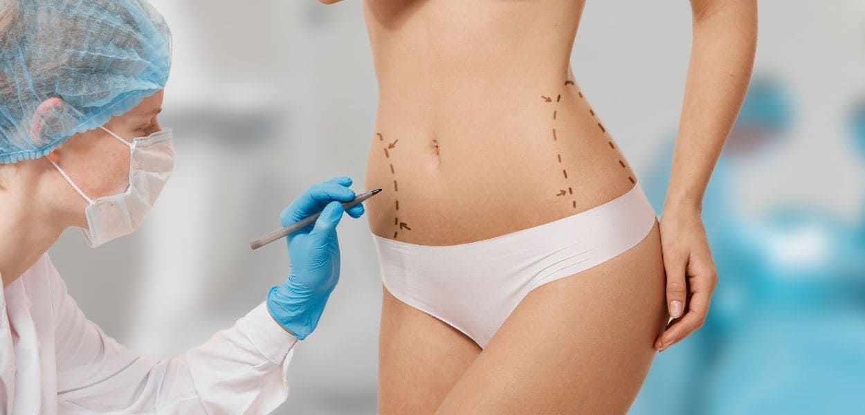 abdominoplasty.jpg