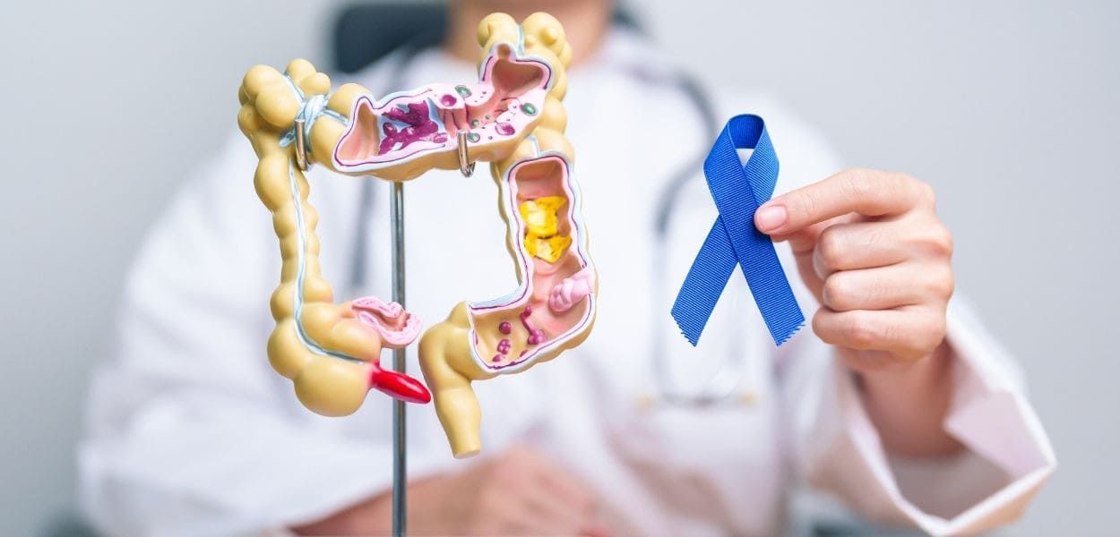 colon-cancer.jpg