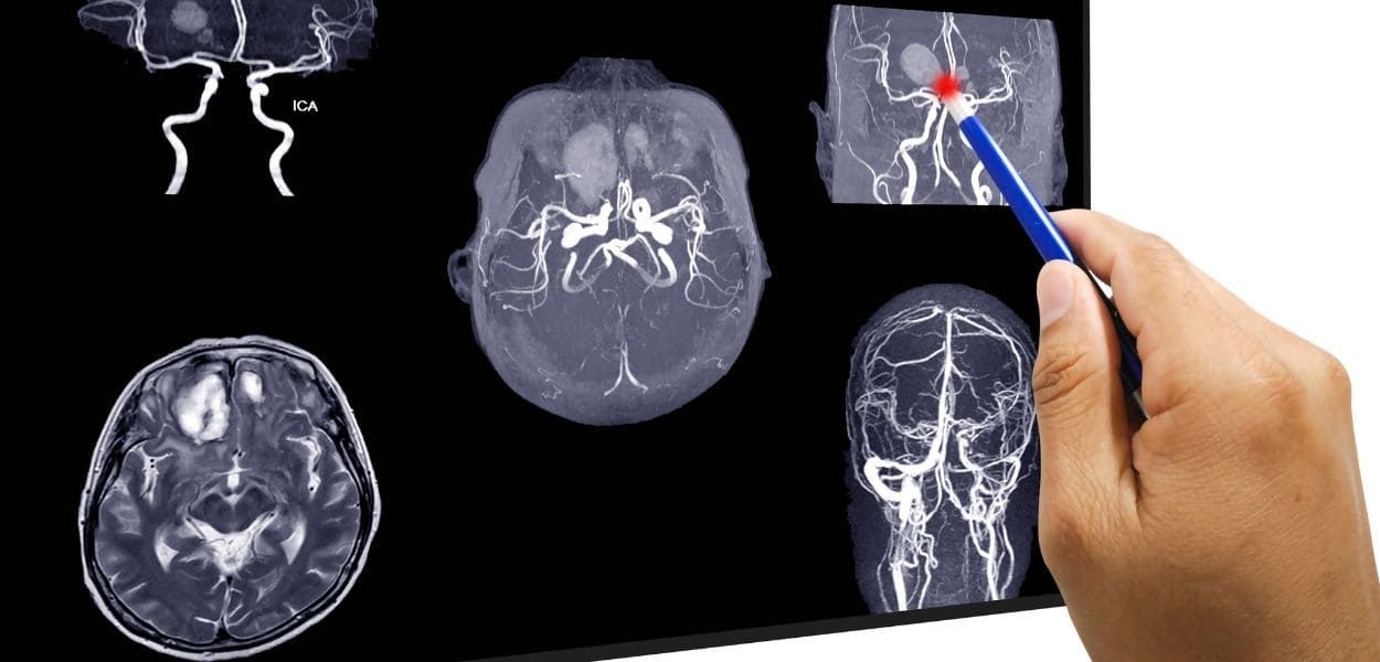 endovascular.jpg