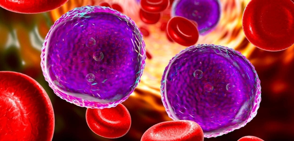 leukemia.jpg