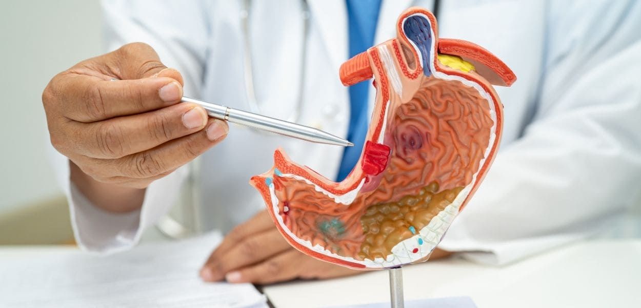 stomach-cancer.jpg